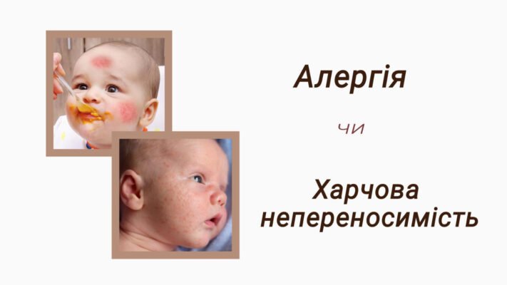 Харчова алергія: як розпізнати алергічну висипку у дитини?