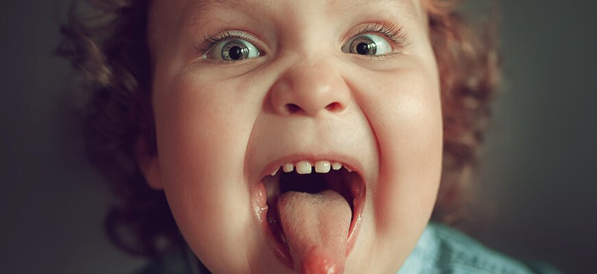 Білий наліт на язику у дитини: можливі причини та лікування