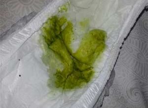 Темно зелений кал у дитини: можливі причини та що робити