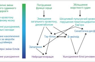 Дисметаболічні зміни міокарда: причини, симптоми та лікування