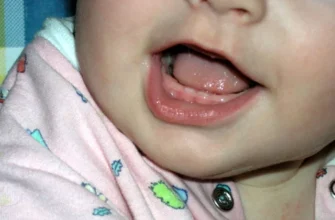 Симптоми при прорізуванні зубів у немовлят: що важливо знати батькам?