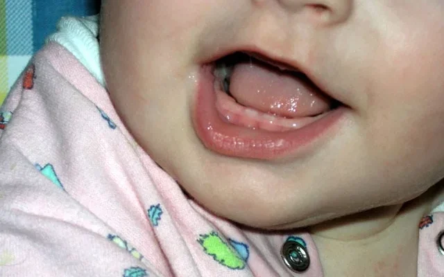 Симптоми при прорізуванні зубів у немовлят: що важливо знати батькам?