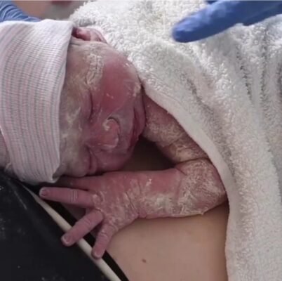 Чи потрібно пеленати дитину: переваги та недоліки пеленання новонароджених