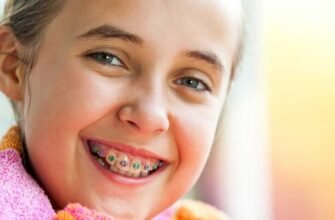 Чи варто ставити брекети дітям: вік 11 років і стоматологічні поради