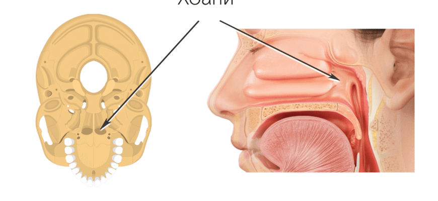 Чи варто видаляти аденоїди: експертна думка та рекомендації лікарів