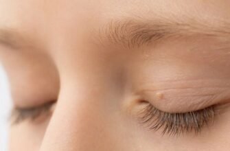 Чи варто видаляти папіломи: обов’язковість процедури та ризики