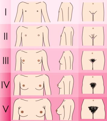 До скількох років продовжується ріст жіночих грудей: основні факти