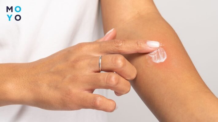 Ефективна боротьба з комарами: як вибрати спіраль для захисту Ефективна боротьба з комарами: як вибрати спіраль для захисту