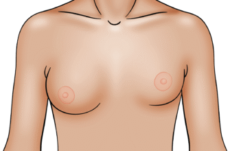 Гулька на грудях у дитини 10 років: причини та методи лікування