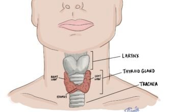 Коли і чому слід видаляти вузол на щитовидній залозі: поради лікарів