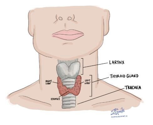 Коли і чому слід видаляти вузол на щитовидній залозі: поради лікарів