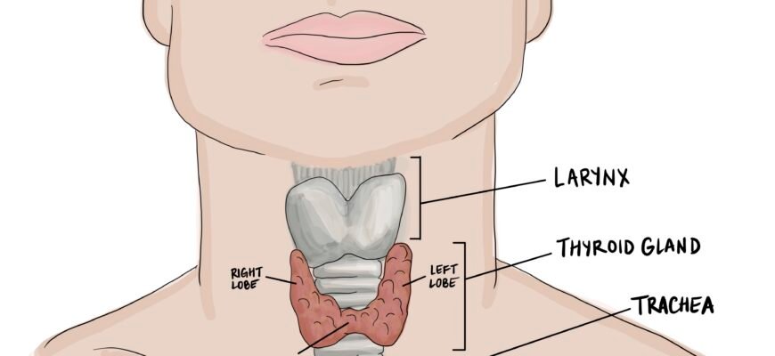 Коли і чому слід видаляти вузол на щитовидній залозі: поради лікарів