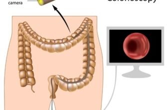 Коли потрібна колоноскопія: Основні показання для процедури