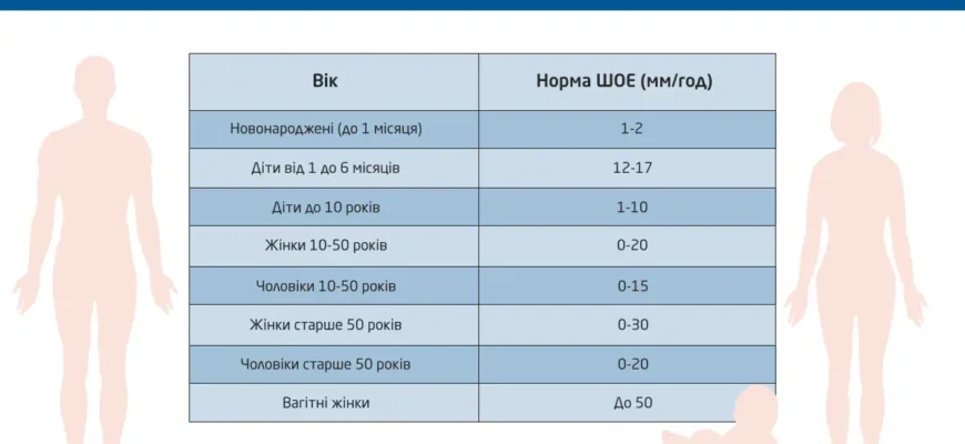 Оптимальний рівень ШОЕ у жінок після 60 років: норми та рекомендації