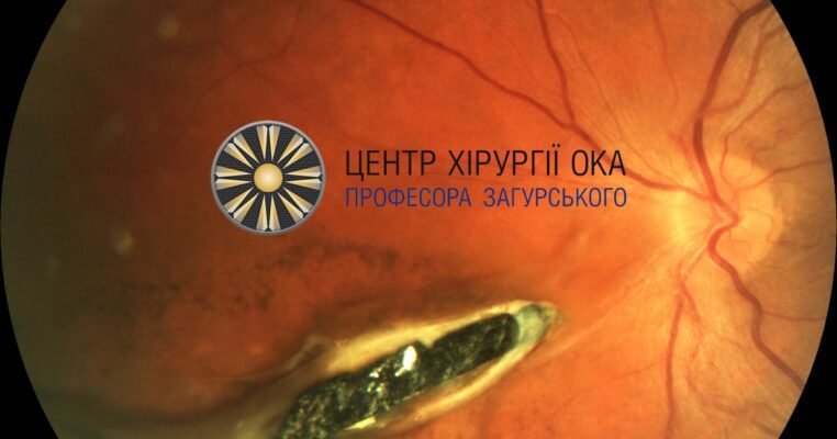 Покращення Очікування: Хорус Як Скоротити Термін Пацієнтів