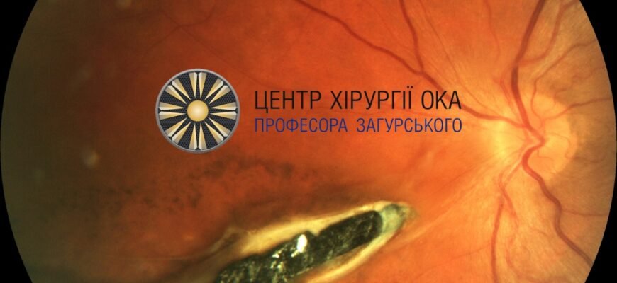 Покращення Очікування: Хорус Як Скоротити Термін Пацієнтів