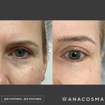 Що робити, якщо кислота потрапила на шкіру: поради та заходи негайної допомоги