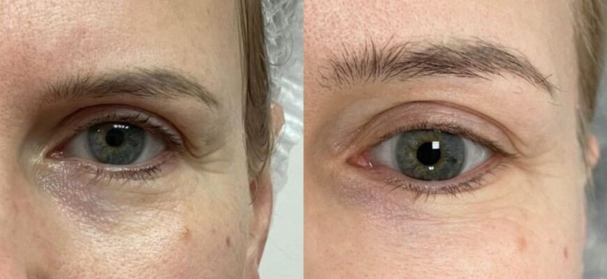 Що робити, якщо кислота потрапила на шкіру: поради та заходи негайної допомоги