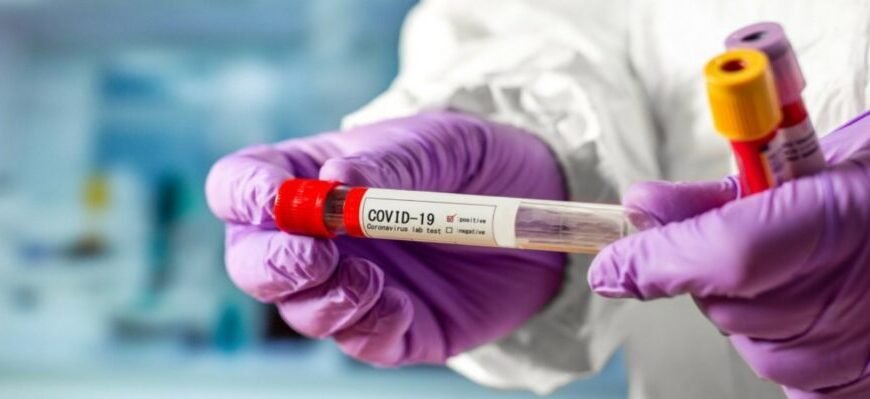 Скільки калу варто здавати на аналіз: точні рекомендації та поради