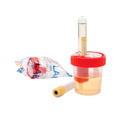 Скільки потрібно сечі для загального аналізу: докладна інструкція.