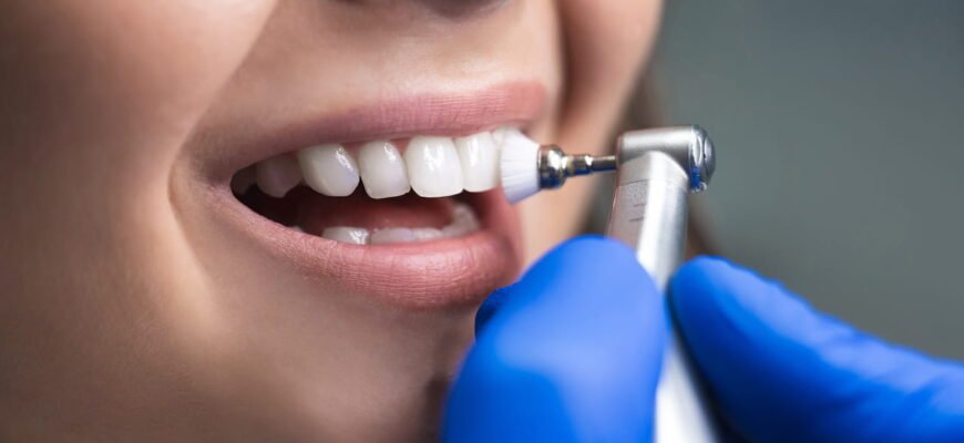 Скільки разів на день варто чистити зуби для здорової усмішки?