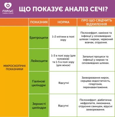 Скільки сечі потрібно зібрати для загального аналізу у дитини?