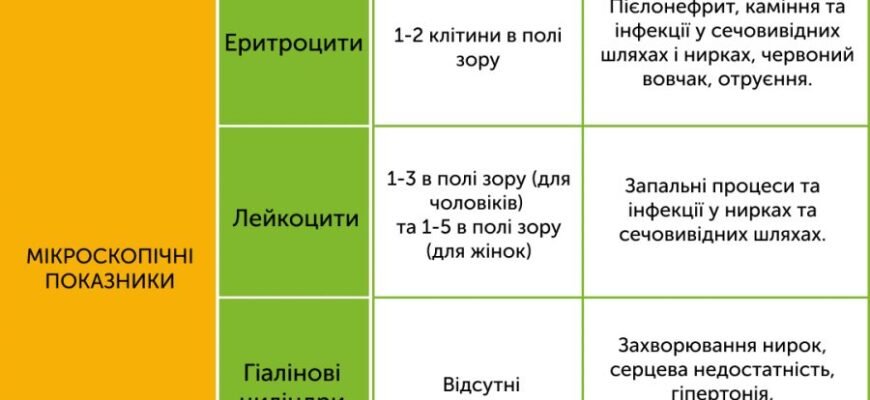 Скільки сечі потрібно зібрати для загального аналізу у дитини?
