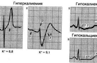 Цікавий психологічний тест-прогноз! | Полтавський державний ...
