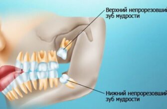 У якому віці починає рости зуб мудрості: ключові особливості росту