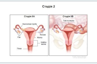Ургентне направлення: дізнайтеся про термін його дії та важливість