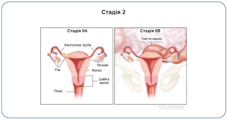 Ургентне направлення: дізнайтеся про термін його дії та важливість