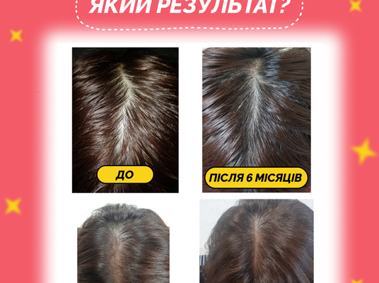 Вагіфлорин: Від чого допомагає та як ефективно використовувати?