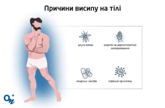 Висипи на шкірі від нервів: фото, причини та методи лікування