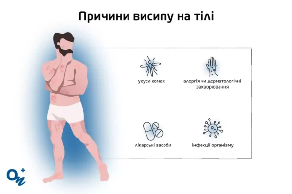 Висипи на шкірі від нервів: фото, причини та методи лікування