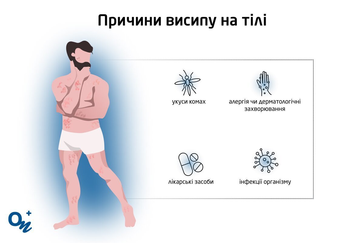 Що може викликати висипання — блог медичного центру ОН Клінік