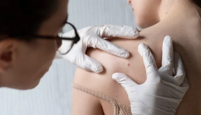 Як часто слід змінювати медичні рукавички: поради від експертів