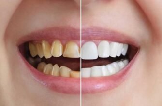 Як часто змінювати зубну щітку: поради для здорових зубів