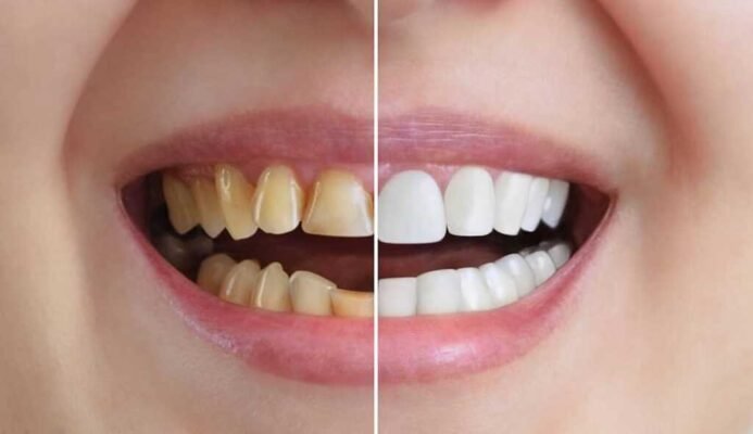 Як часто змінювати зубну щітку: поради для здорових зубів