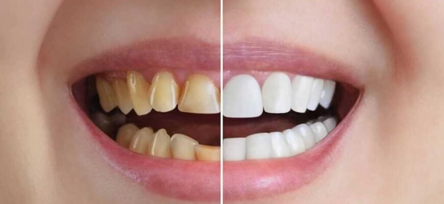 Як часто змінювати зубну щітку: поради для здорових зубів