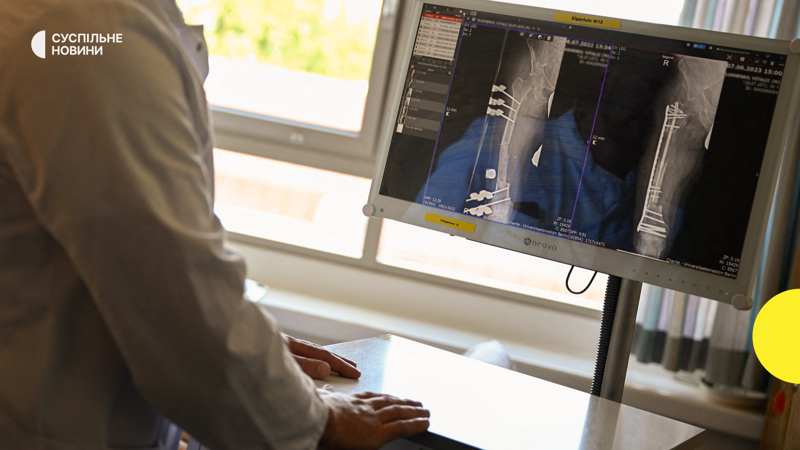 Замінити МСЕК: чому її ліквідовують, та що буде замість неї ...