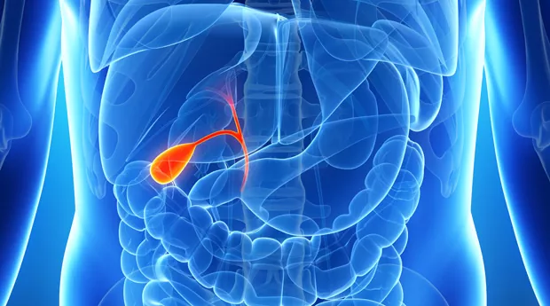 Клініка Біляка | Рак жовчного міхура (жовчних проток) лікування в ...