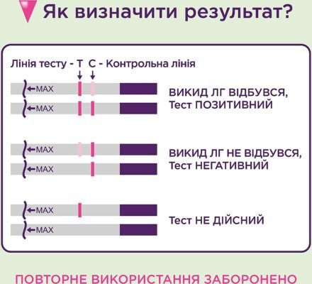 Як точно визначити термін вагітності: поради для майбутніх мам Як точно визначити термін вагітності: поради для майбутніх мам