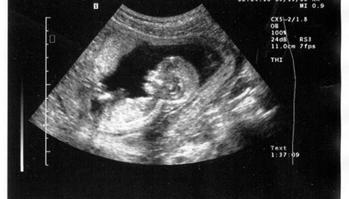 Як визначити точний термін вагітності: поради та рекомендації