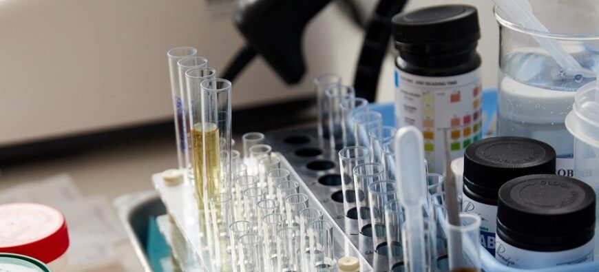 Яку сечу потрібно здавати для різних медичних аналізів: повний гід.