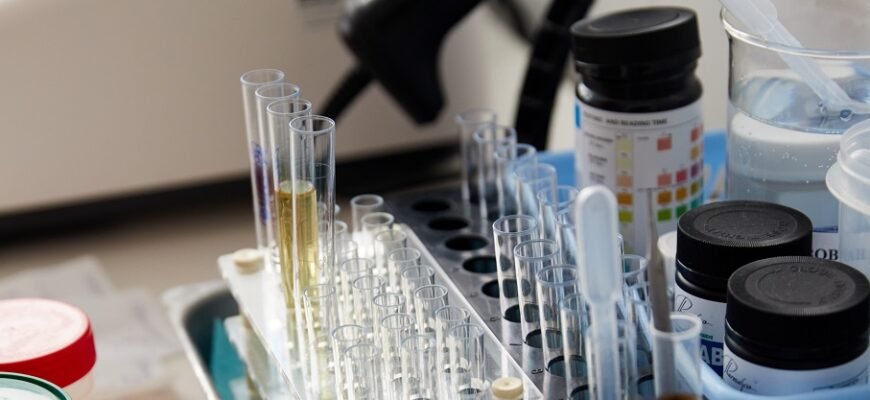 Яку сечу потрібно здавати для різних медичних аналізів: повний гід.