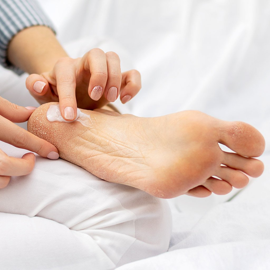 Болять та печуть ступні ніг: лікування та профілактика - FitoBlog