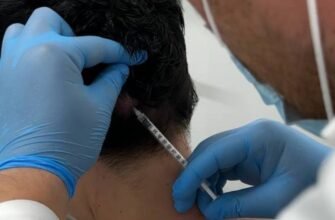 Ботокс від мігрені: яка ціна процедури та її ефективність?