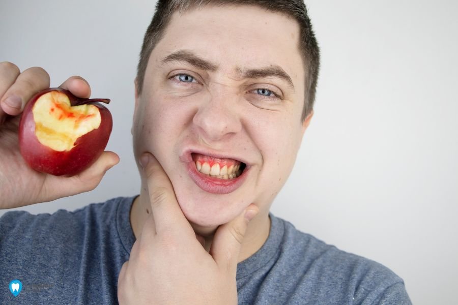 Що Робити Якщо Кровоточать Ясна — Клініка Лукашука