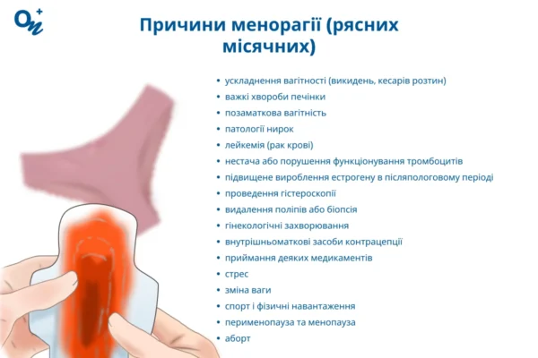 Чи можуть менструальні болі спричинити серйозні ризики для здоров’я?