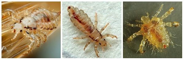 Від чого з'являються воші: джерела появи вошей у людини - СадФасад